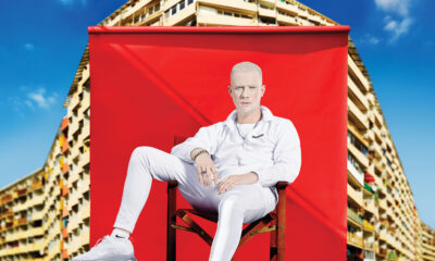 kabe albinos