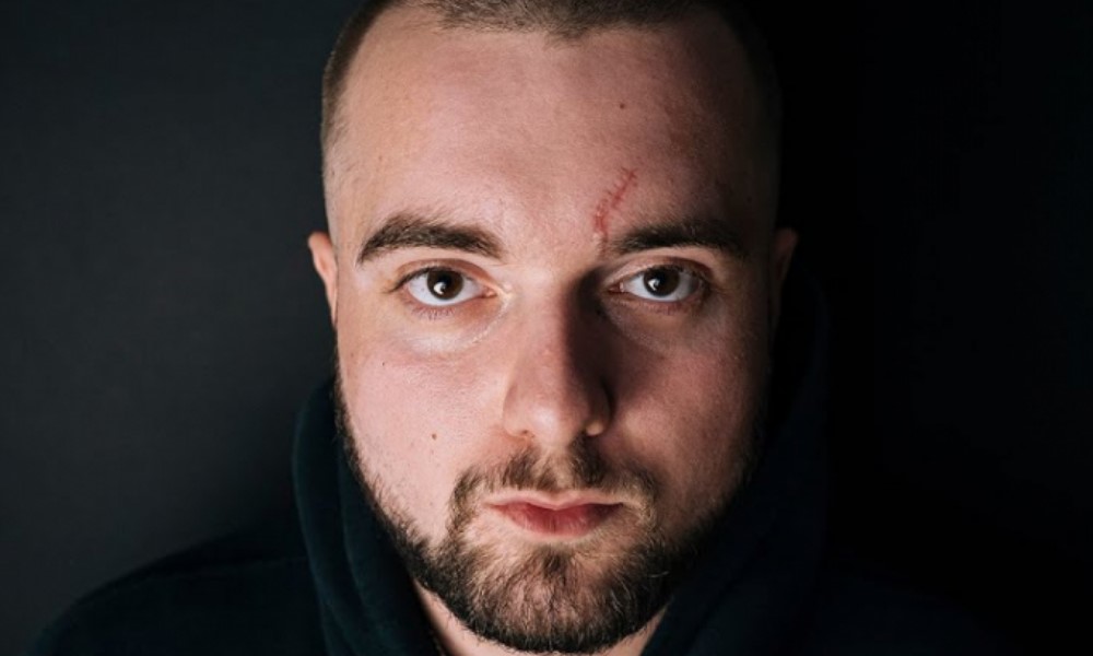 Blizna na czole Bedoesa po spotkaniu z Żabsonem.