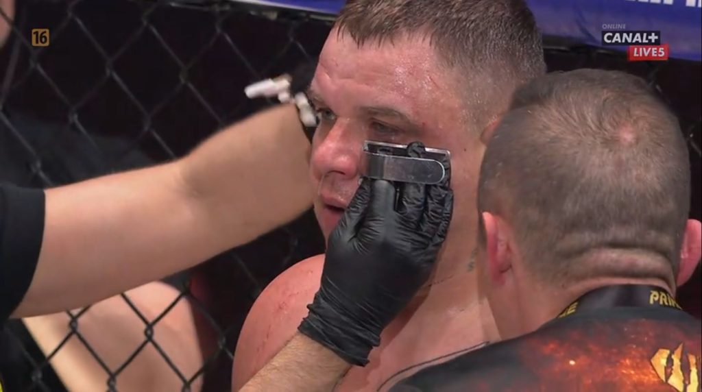 waszka g ali wynik walki